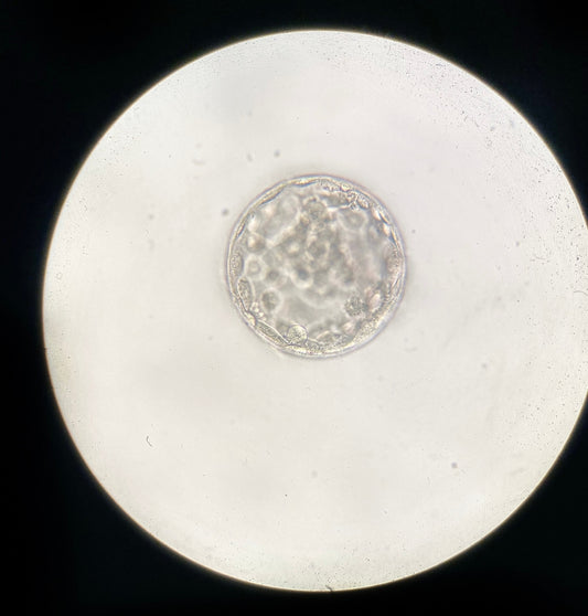Embryo Grading and what does it all mean?